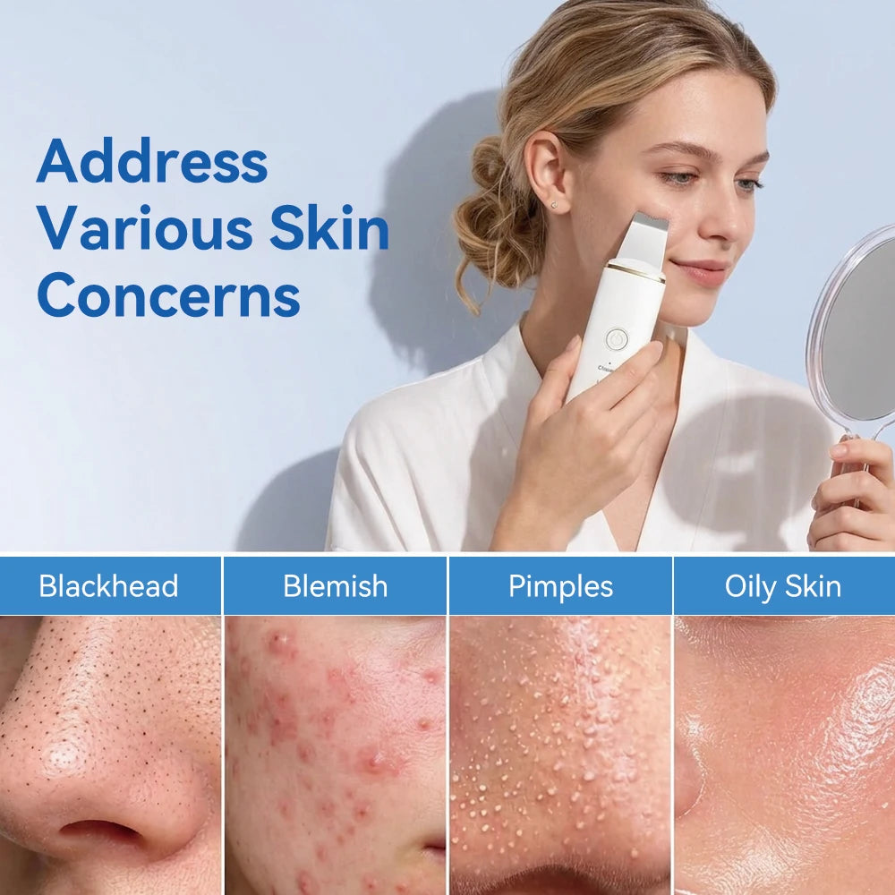Revelloa Ultrasonic Skin Scrubber